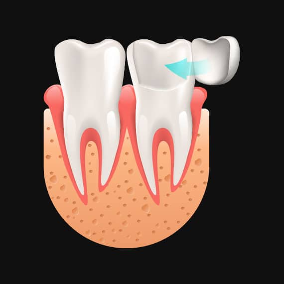 Cosmetic Dentistry in Vancouver