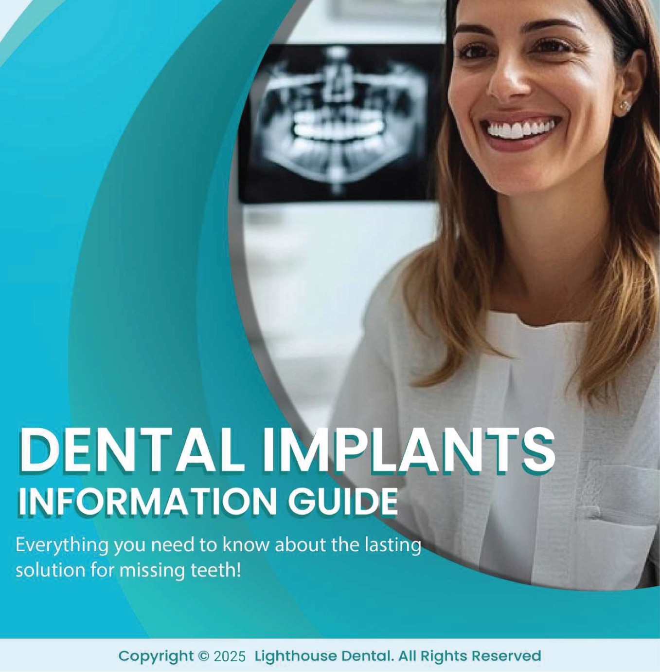 dental implants information guide