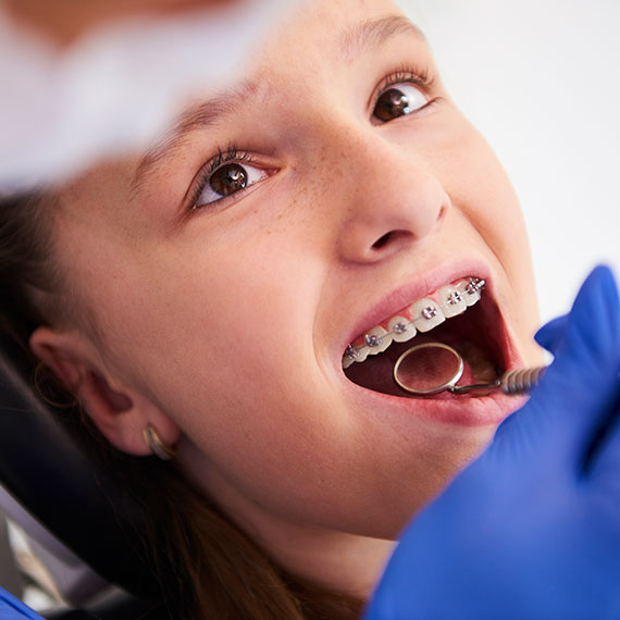 Pediatric dentist in Vancouver