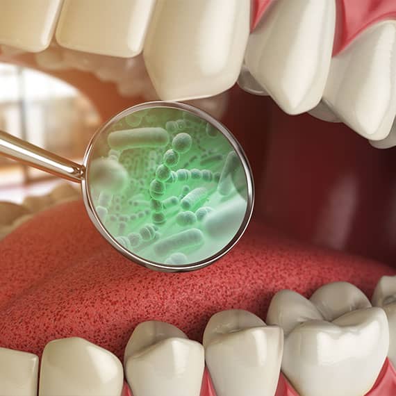 Periodontal Disease Treatment in Vancouver