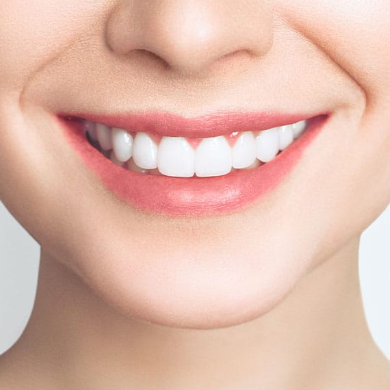 Snap-On Smile in Vancouver